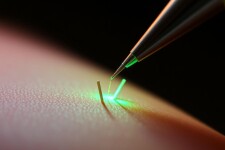 Микроигольчатый РФ-лифтинг: как маленькие иглы возвращают упругость коже