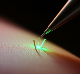 Микроигольчатый РФ-лифтинг: как маленькие иглы возвращают упругость коже