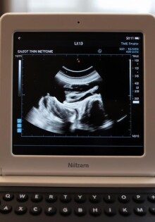 УЗИ на дому: когда это удобно, как проходит и на что обратить внимание